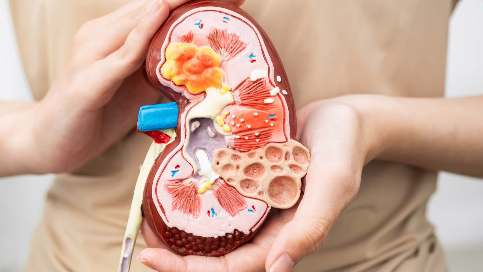 Does Alcohol Cause Kidney Stones Yes, though in an indirect way