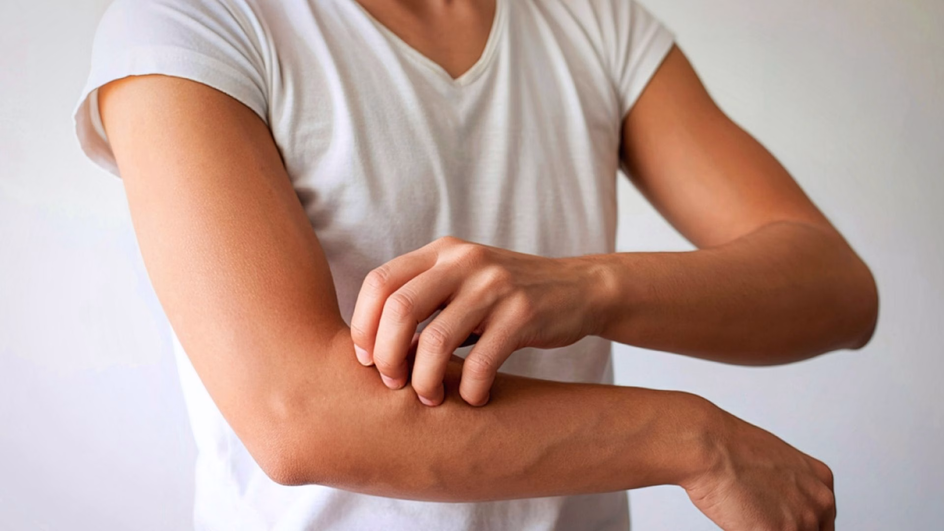 opioid use disorder can cause itchy skin as a symptom